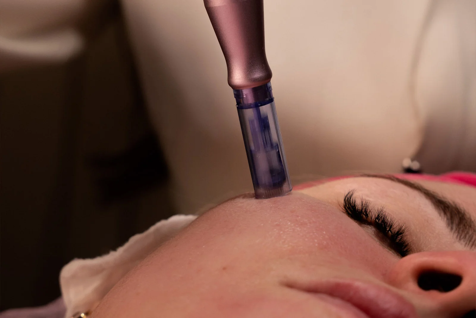 zabieg dermapen wrocław