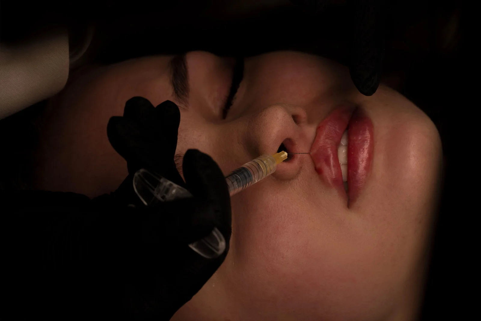 rozpuszczanie ust wrocław