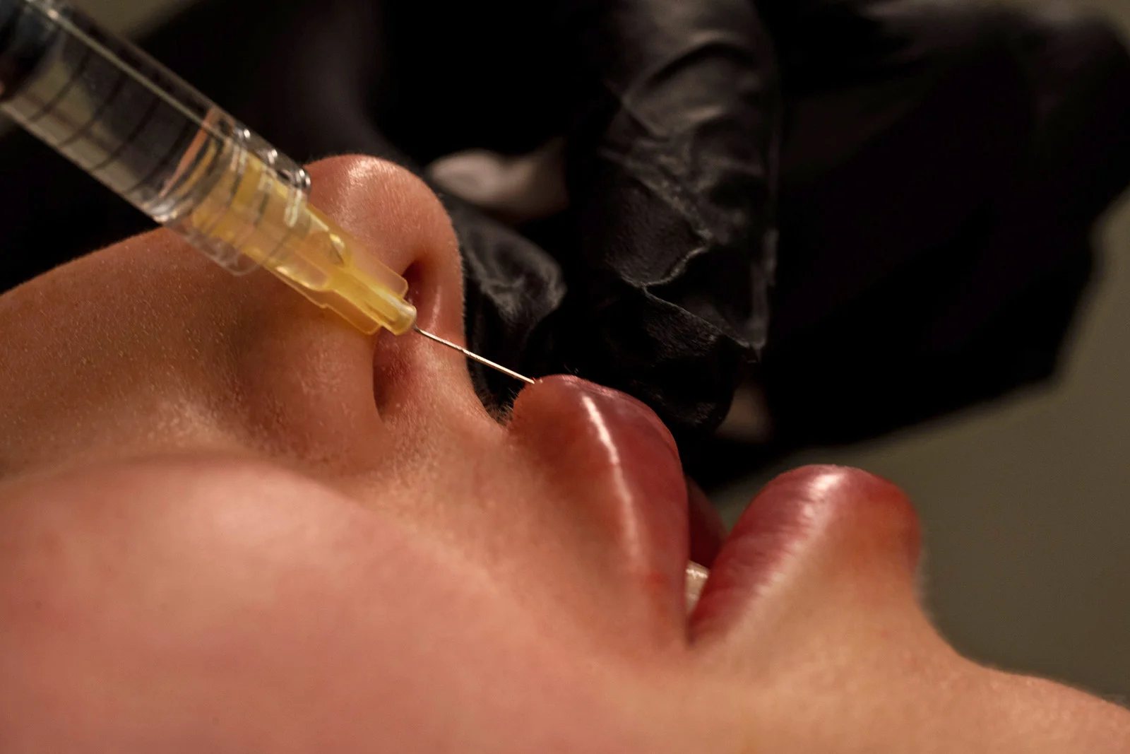 modelowanie ust wrocław